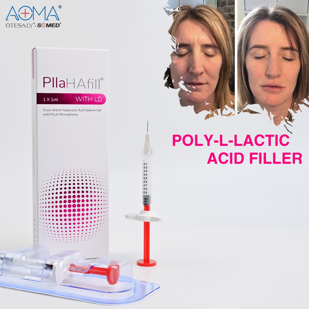 图片 2 普拉哈填充剂