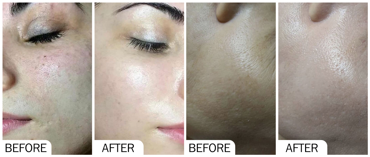 皮膚提亮膚色前後 AOMA